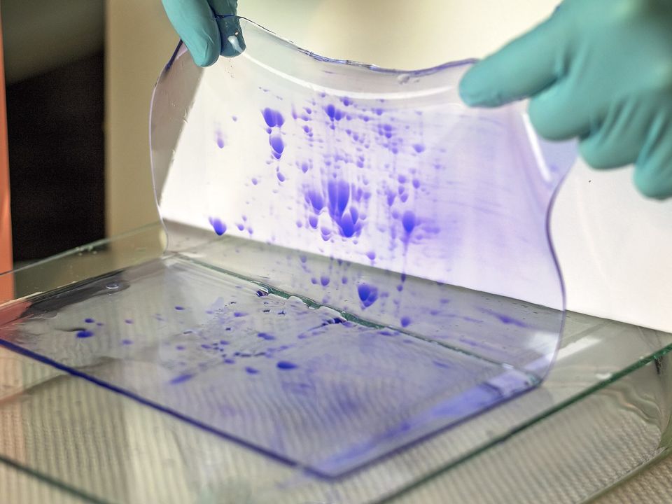 How to Prepare Samples for 2D Gel Electrophoresis: A Comprehensive Step-by-Step Protocol